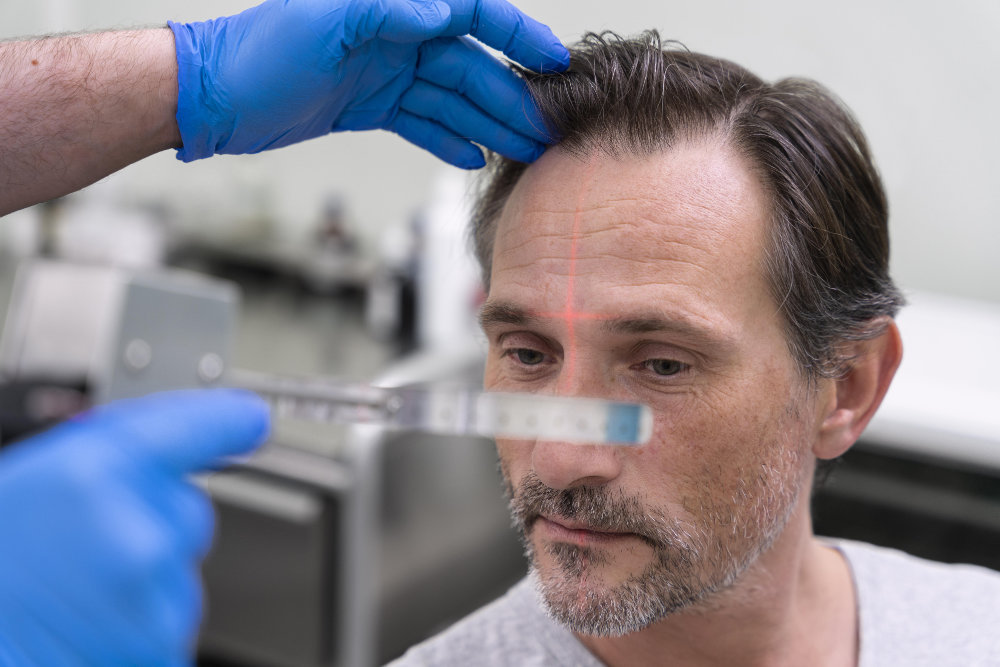 Dentist Cape Town | Hair Restoration Treatments