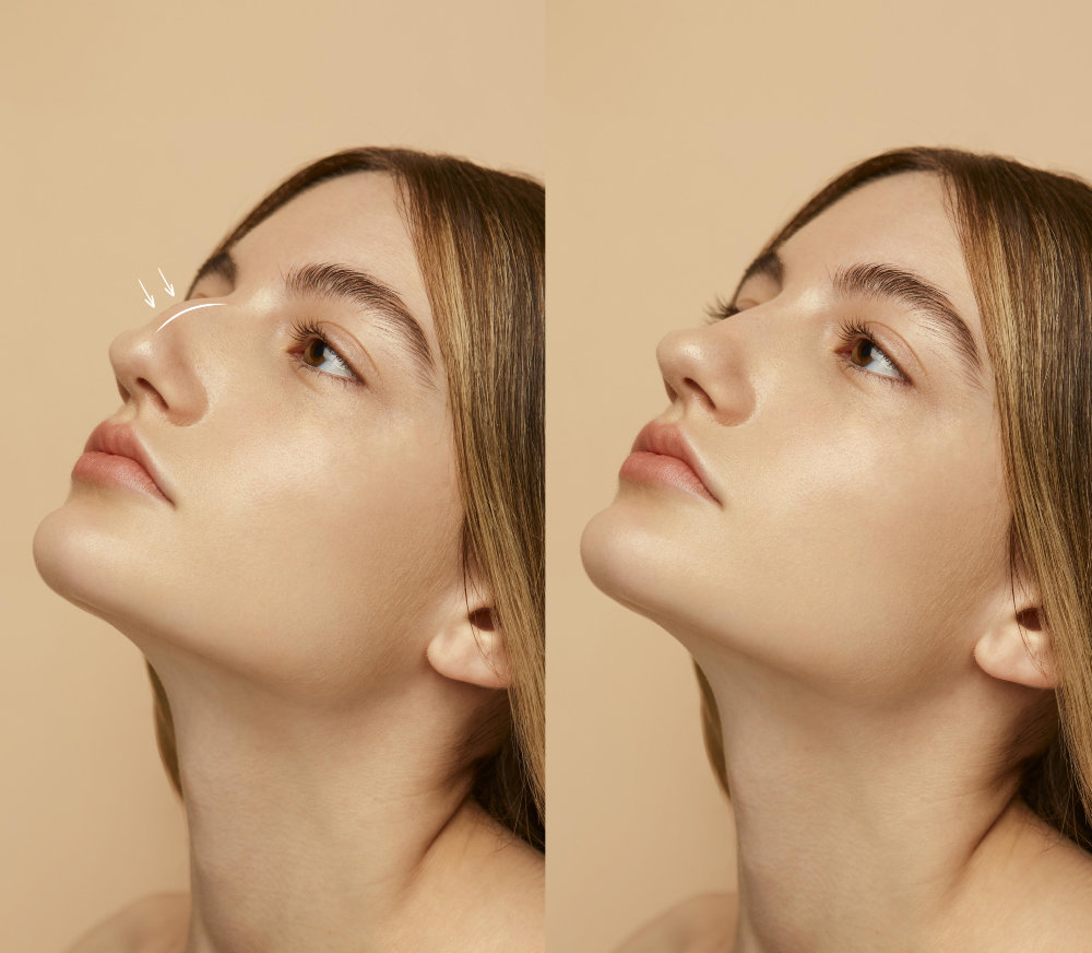 Dentist Cape Town | Facial Contouring & Lifting